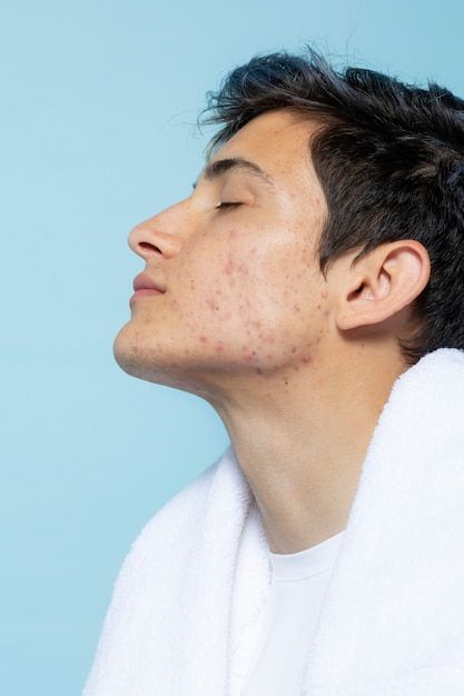 Ready to Take Care of Your Skin?
